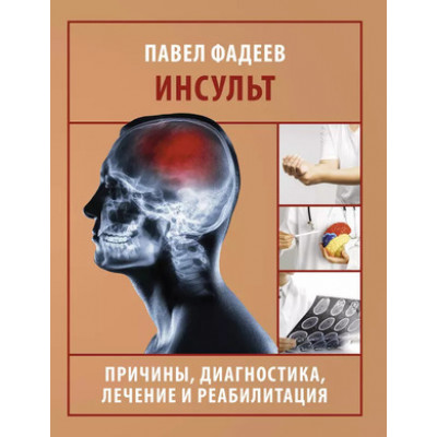 АзбукаЗдоровья Инсульт Причины,диагностика,лечение и реабилитация (Фадеев П.А.)